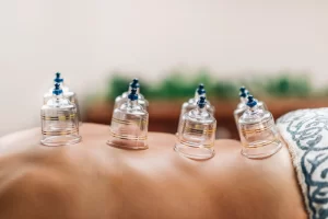 Read more about the article Hijama Therapy : The Effects and Benefits of Cupping Therapy